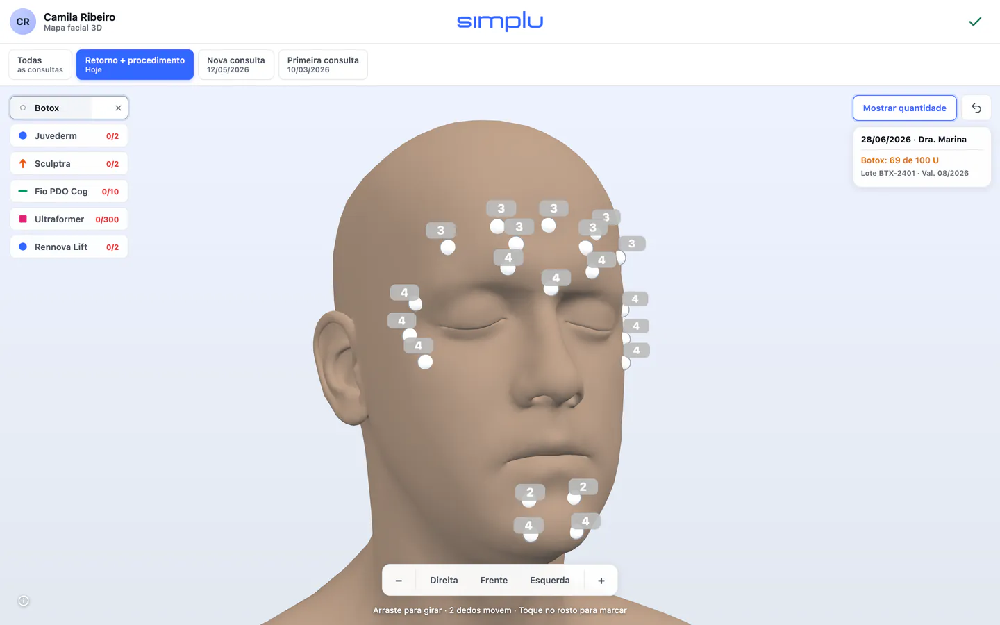 Mapa facial 3D do Simplu com os pontos de aplicação marcados no rosto do paciente